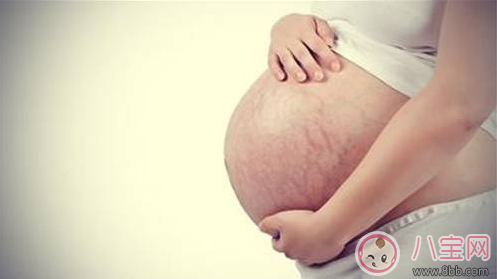 预防妊娠纹|妊娠纹什么时候长怎么预防妊娠纹