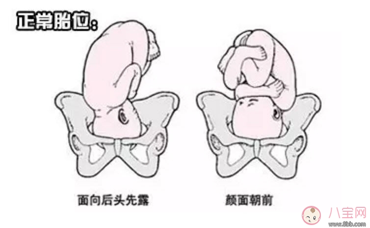 胎位不正|孕期胎位不正的原因 如何矫正胎位不正