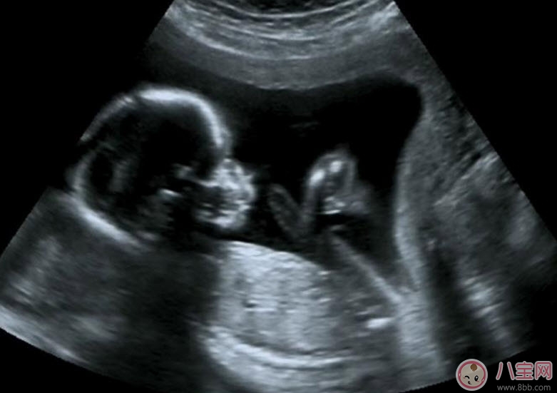 阴道B超|孕早期做阴道B超会影响胎儿吗 阴式b超和b超的区别