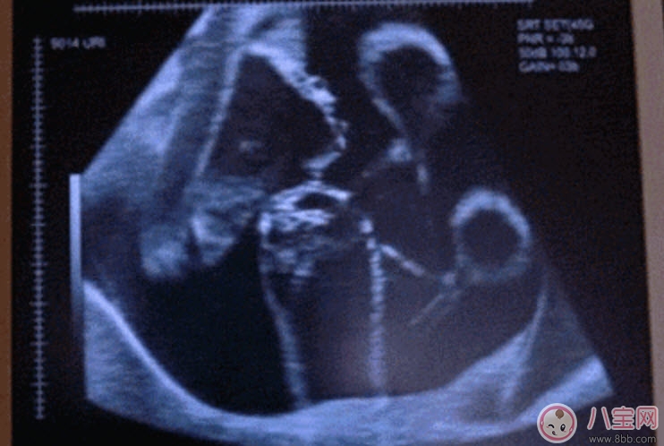 胎动|孕晚期胎动频繁正常吗 孕晚期胎动时间