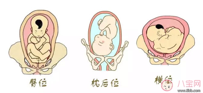 胎位|孕晚期胎位不正怎么办 孕晚期胎位图