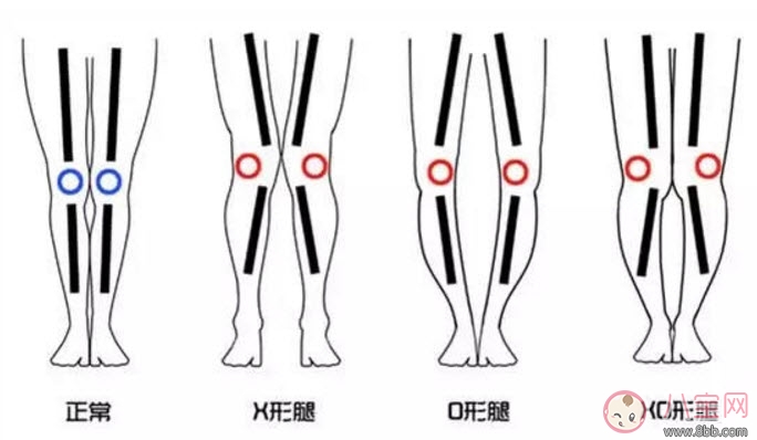 腿型|怎样让宝宝有大长腿 宝宝腿型注意事项