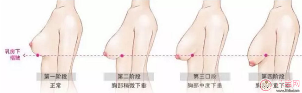 阶段|你的胸部大小正常吗不同阶段的女性乳房尺寸不同