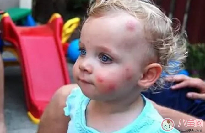 驱蚊|夏天宝宝驱蚊方法大全 宝宝驱蚊成分哪种安全有效