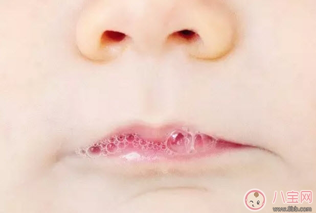 吐泡泡|宝宝吐泡泡就是肺炎吗 宝宝吐泡泡是怎么回事