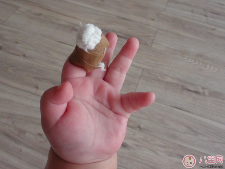 手指|宝宝手指头划伤了怎么办 孩子手指头划伤处理方法