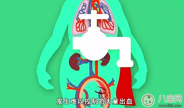 健康|哪些人更容易产后出血 产后出血发病症状(如何预防产后大出血)