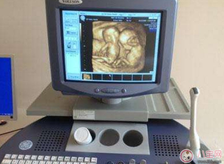 B超|孕妇四维彩超的最佳时间 孕妇一定要做四维彩超吗