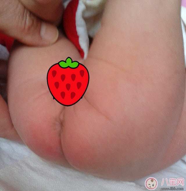 护臀膏|贝亲护臀膏可以擦脸吗 贝亲婴儿护臀膏能天天用吗