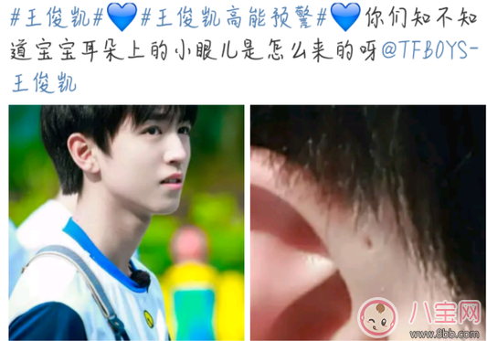 耳朵|孩子耳朵上面有小孔是什么 耳朵的小孔是富贵孔吗