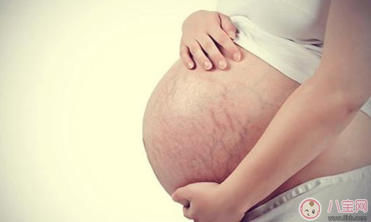妊娠|孕妇妊娠纹怎么预防 孕妇预防妊娠纹吃什么