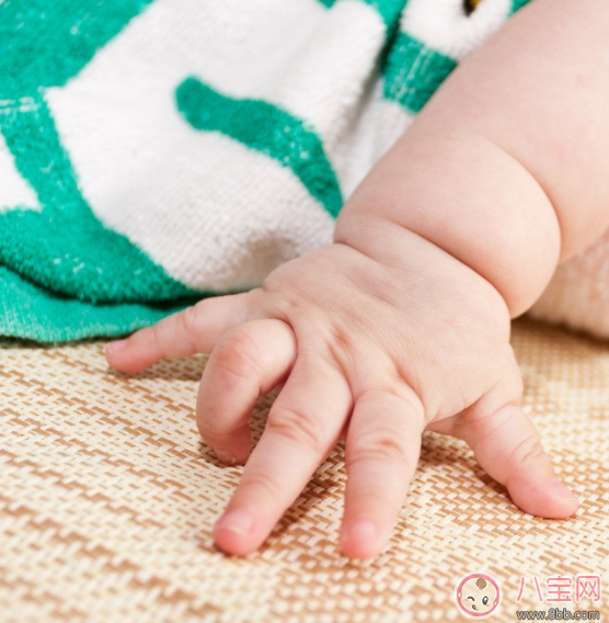 倒刺|孩子手上长倒刺 宝妈应该这么做