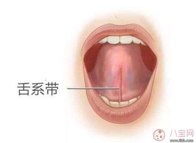 宝宝|宝宝舌系带过短怎么办 舌系带过短一定要做手术吗