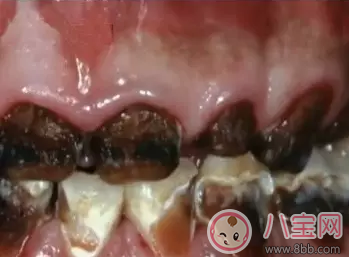 喝水|孩子喜欢喝碳酸饮料 不妨让他知道水果的魅力