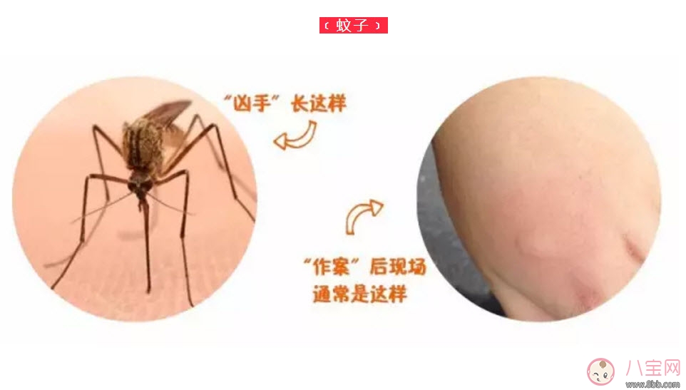 蚊子|宝宝被蜱虫咬了症状图片 宝宝被蜱虫咬和蚊子咬症状对比图片区别