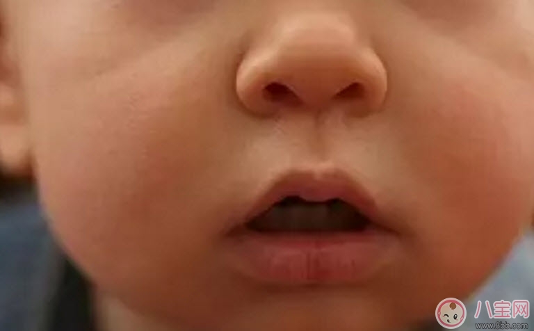 口角炎|秋天怎么预防宝宝口角炎 宝宝口角炎的食疗方法