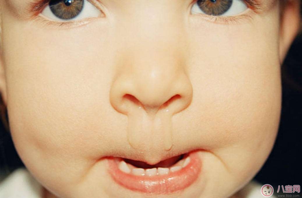 育儿|宝宝流鼻涕的原因 如何缓解宝宝流鼻水的问题