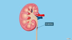 小儿泌尿感染需对症护理