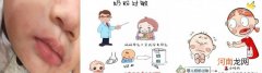 奶粉过敏的症状及处理方法 婴儿喝奶粉过敏怎么办