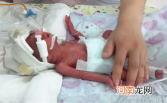 教你护理早产儿要记住的4个妙招