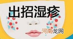 花椒食用盐水治愈湿疹 湿疹最佳治疗土方法是什么
