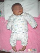 新生儿脑瘫能治好吗？