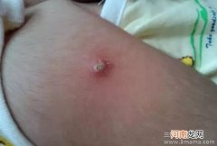 早产儿什么时候可接种卡介苗