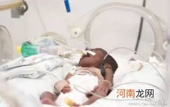 如早产儿发现病症及如何诊