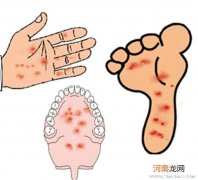 小儿声嘶哑当心呼吸道疾病