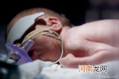 父母要关注早产儿的眼睛