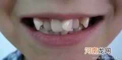 牙齿矫错颌畸形的矫正时机