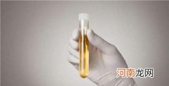 尿常规的检查报告怎么解读 尿常规检查结果分析