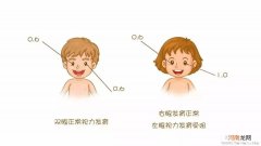 怎样有效预防小儿弱视