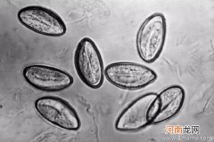防治儿童蛲虫病的食疗方