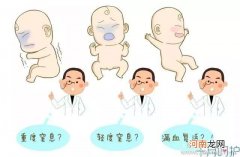 出生时窒息后天弥补一样棒