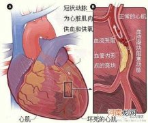 发热吐泻谨防心肌损害
