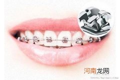 如何矫正“O”和“X”型腿