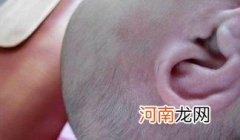 宝宝奶粉过敏的症状及解决方法 宝宝奶粉过敏怎么办