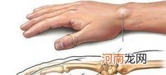 腱鞘囊肿针灸能治好吗 腱鞘囊肿的临床治疗方法