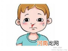 孩子鼻出血后仰是误区