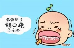 4招帮你缓解宝宝鼻塞 宝宝鼻塞怎么办