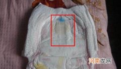 分辨尿布疹注意这4点 尿布疹图片大全