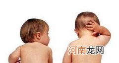 5大方法快速止痱 快 小孩子长痱子怎么办
