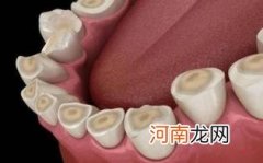 为什么人睡觉的时候会磨牙优质