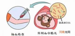 认识无创DNA产前检测 无创产前基因检测