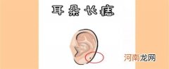 是福 男人耳朵长痣是福是祸
