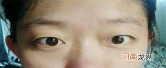 孩子单双眼皮是不是遗传爸爸的