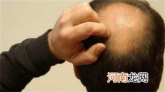哪些方法可以减少脱发