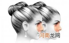 做膨体隆鼻如何避免感染