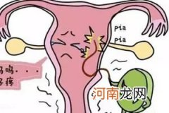 清宫不干净的症状有哪些